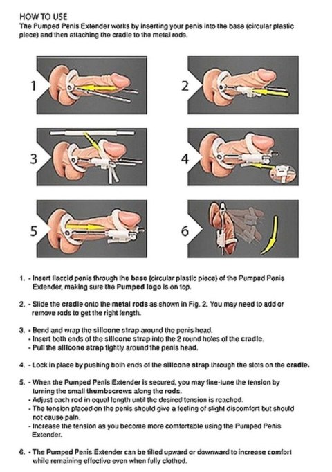 Penis Extender - Black Penis Extender - Black